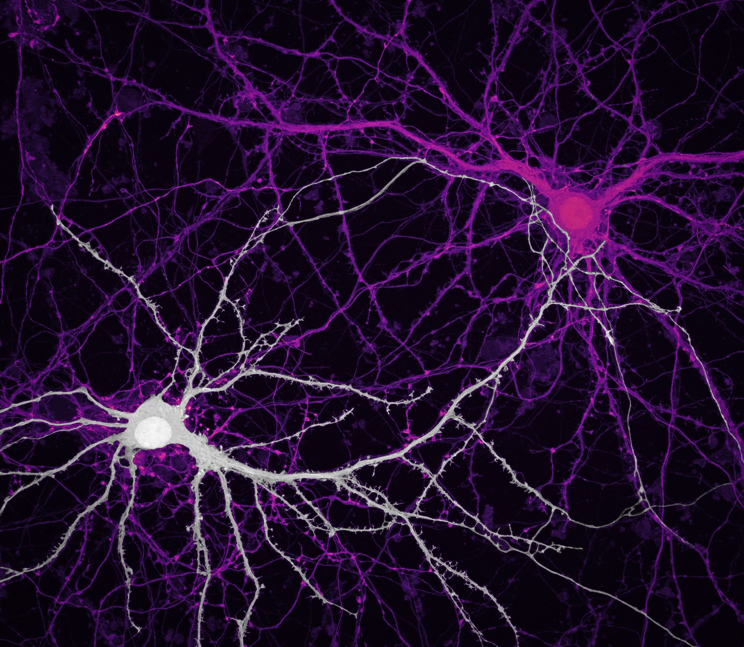 Нейроны гиппокампа (клетки мозга)